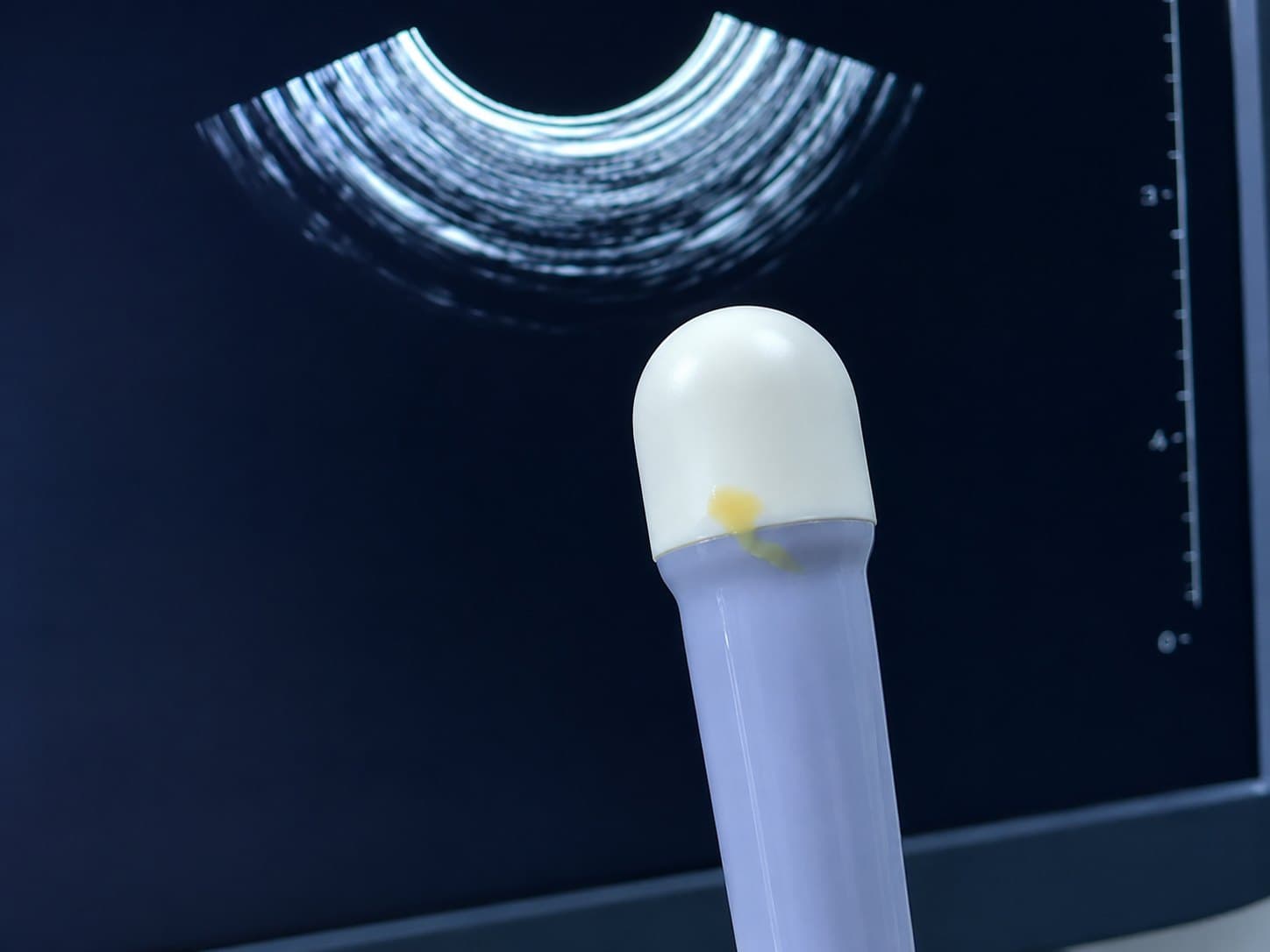 3D/4D ultrahangfej olajszivárgással és rendellenes képalkotással